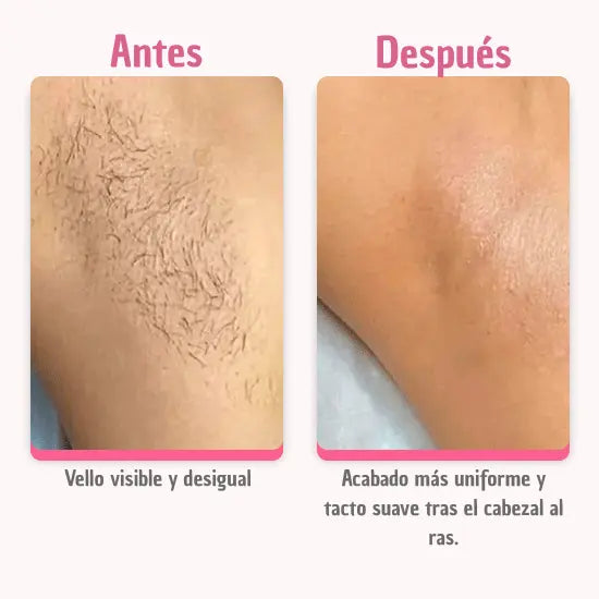 Afeitadora 2-en-1 para zonas sensibles