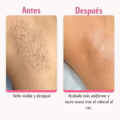 Afeitadora 2-en-1 para zonas sensibles