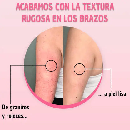 Exfoliante para Piel Sin Puntitos