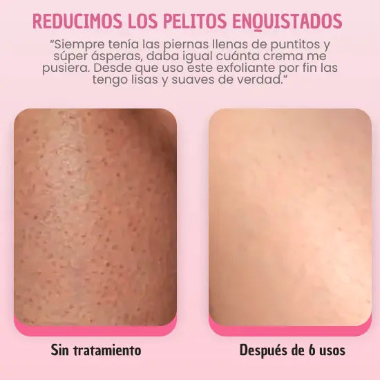 Exfoliante para Piel Sin Puntitos