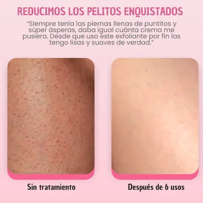 Exfoliante para Piel Sin Puntitos
